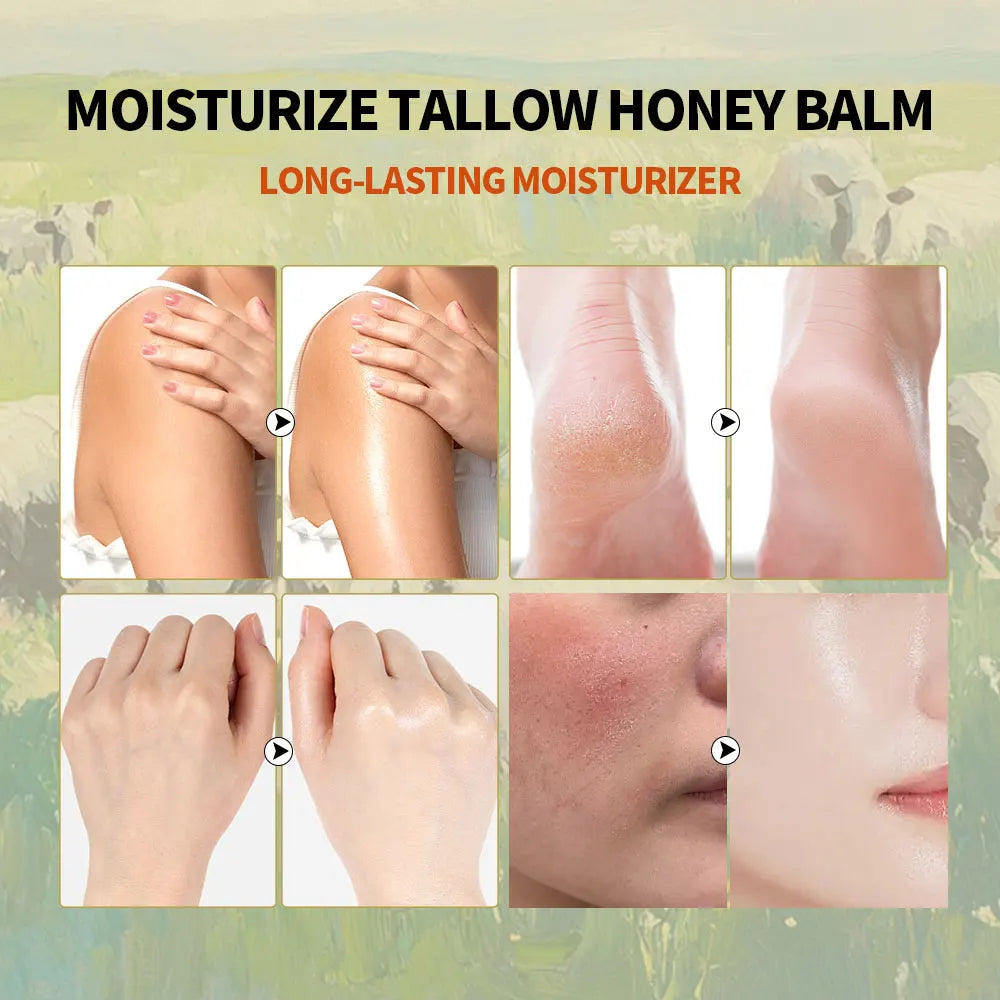 Honey Moisturizer Skincare Things Skin Lightening Cream Face Masks Skin Care Products Moisturizing Body Cream Beauty Make-up